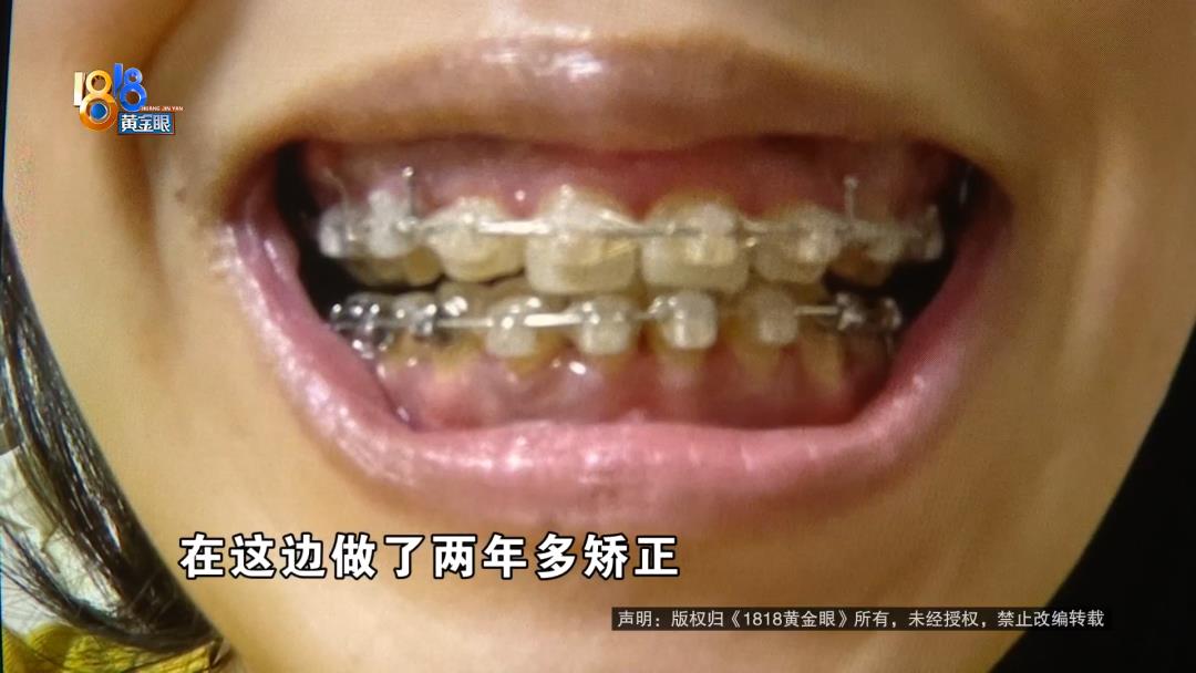 DƬ